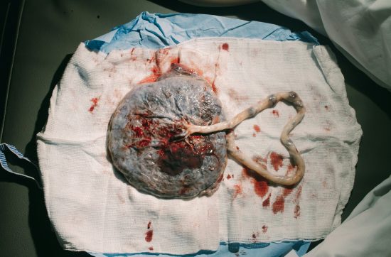 Imagen de una placenta